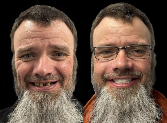 Before After Image