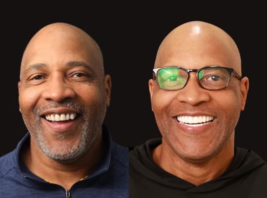 Before After Image