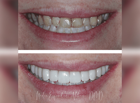Before After Image