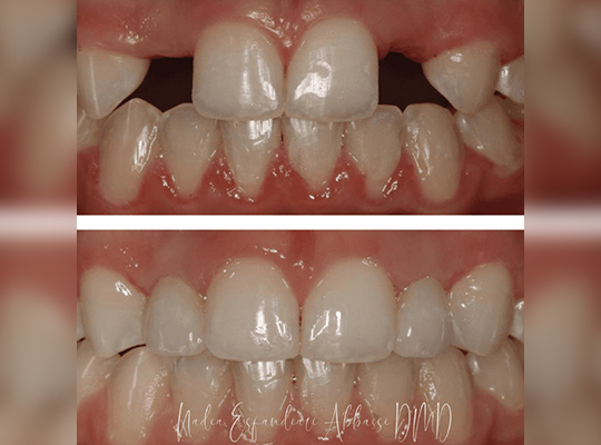 Before After Image